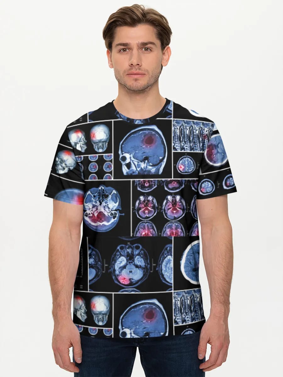 Neuro-Scan-Collage